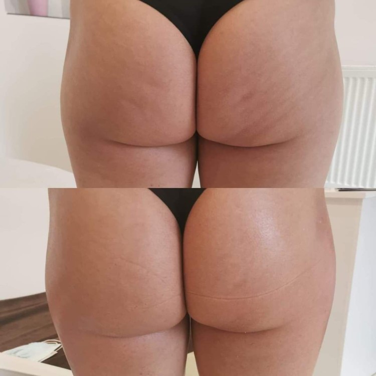 Zdjęcie WhatsApp 2025-07-03 o 16.15.16_a4b70003 (4).jpg